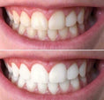 Load image into Gallery viewer, AP24 Whitening Toothpaste