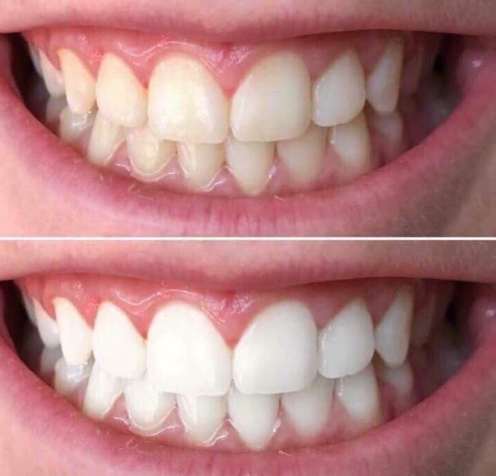 AP24 Whitening Toothpaste