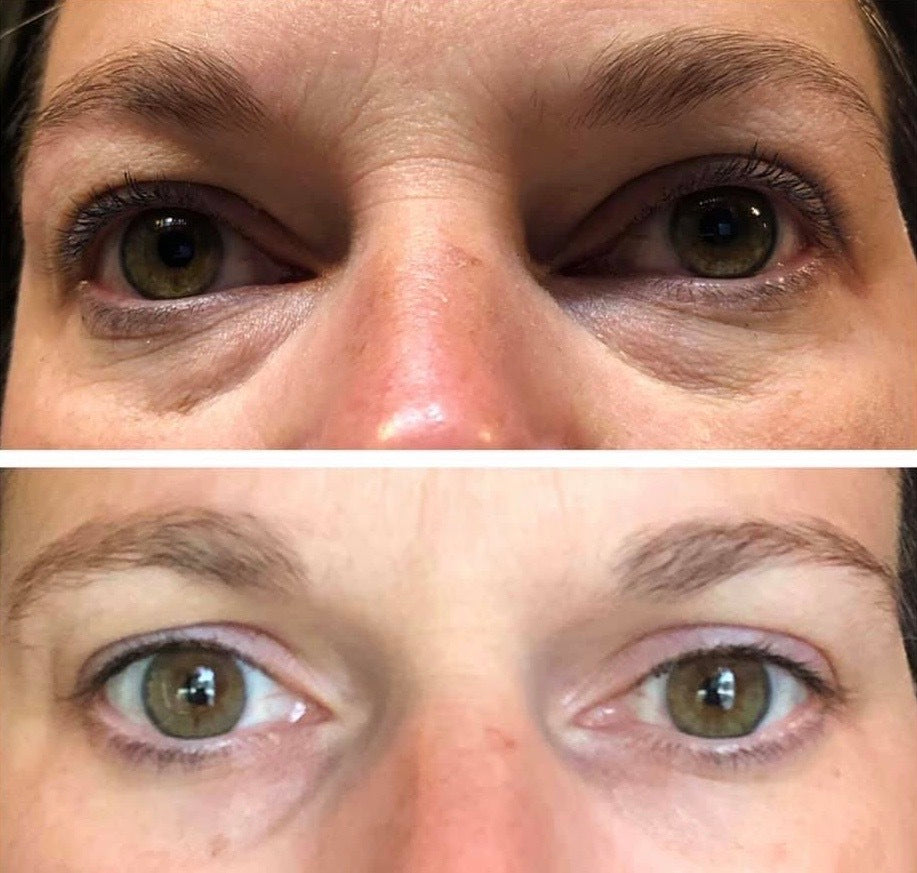 Ideal Eyes