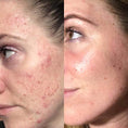 Load image into Gallery viewer, 180°® AHA Facial Peel and Neutralizer