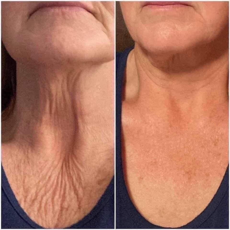 Firming Lotion