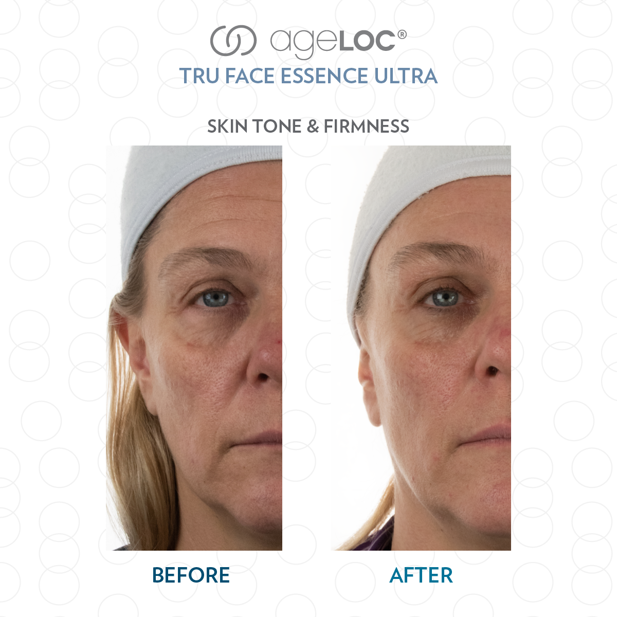 TFEU AgeLoc Uplifting Pearls