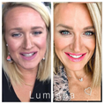 Load image into Gallery viewer, Lumispa iO SALE (free collagen + lip mask)